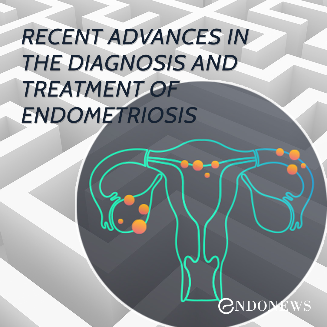 Recent advances in the diagnosis and treatment of endometriosis EndoNews