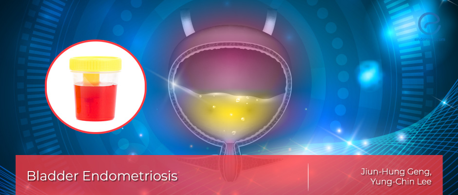 Endometriosis in the Urinary Bladder