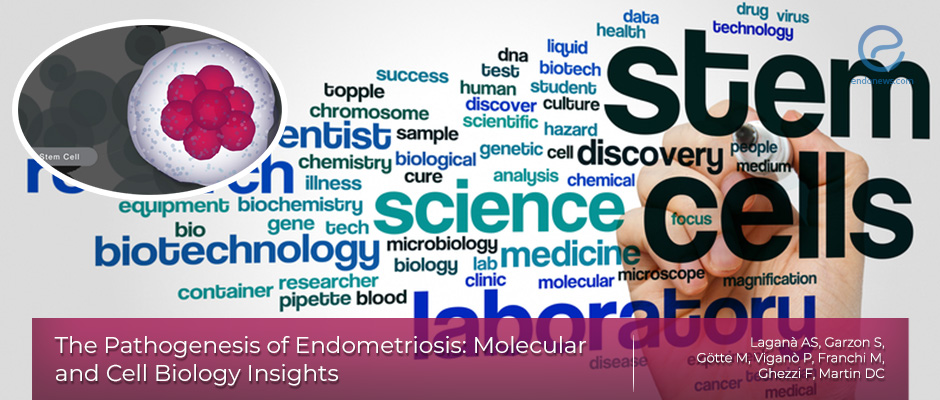 A comprehensive review on the etiopathogenesis of endometriosis