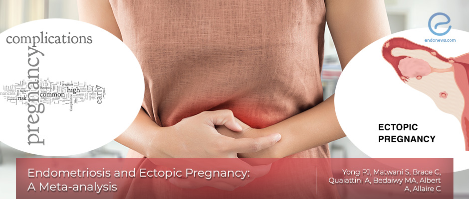 The association between endometriosis and ectopic pregnancy