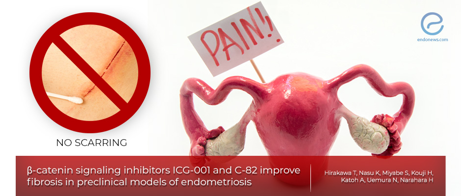β-catenin signaling, a new therapeutic target in endometriosis