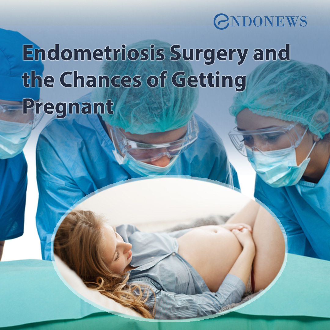 Endometriosis Surgery and the Chances of Getting Pregnant EndoNews