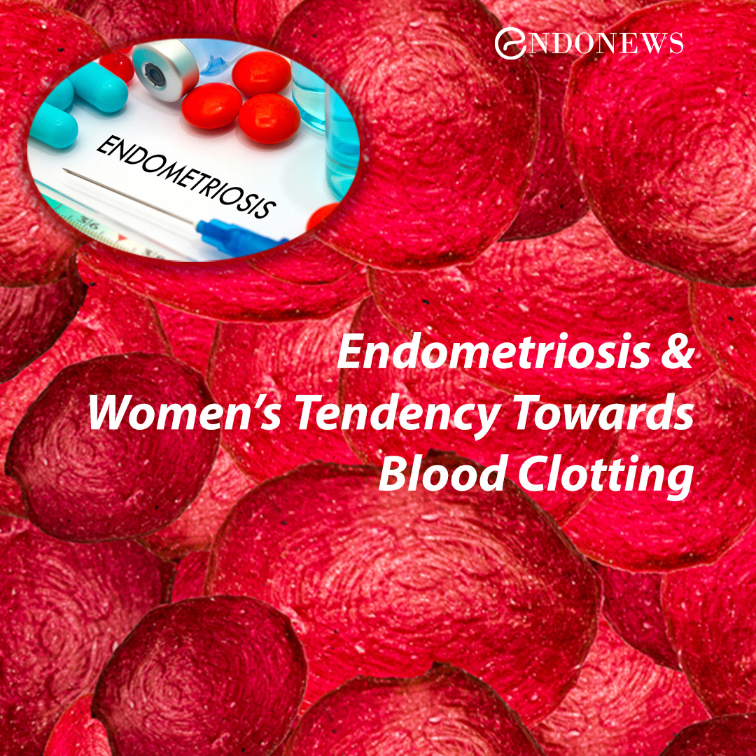 Endometriosis and Women’s Tendency Towards Blood Clotting EndoNews