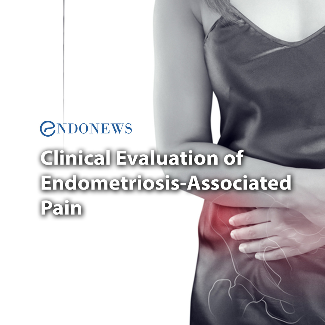 Clinical Evaluation of EndometriosisAssociated Pain EndoNews