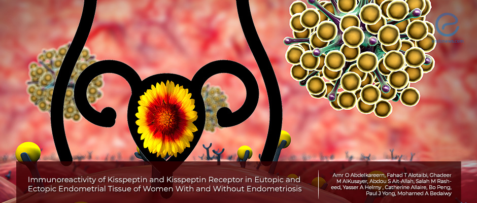 Kisspeptin and its Receptor in the Pathogenesis of Endometriosis
