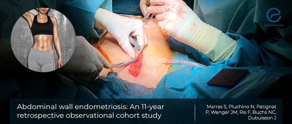 Abdominal wall endometriosis: Who is at risk and what causes it?