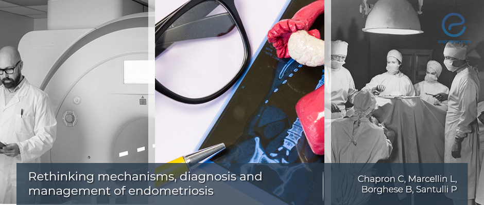 All aspects of endometriosis reviewed with focus on modern management