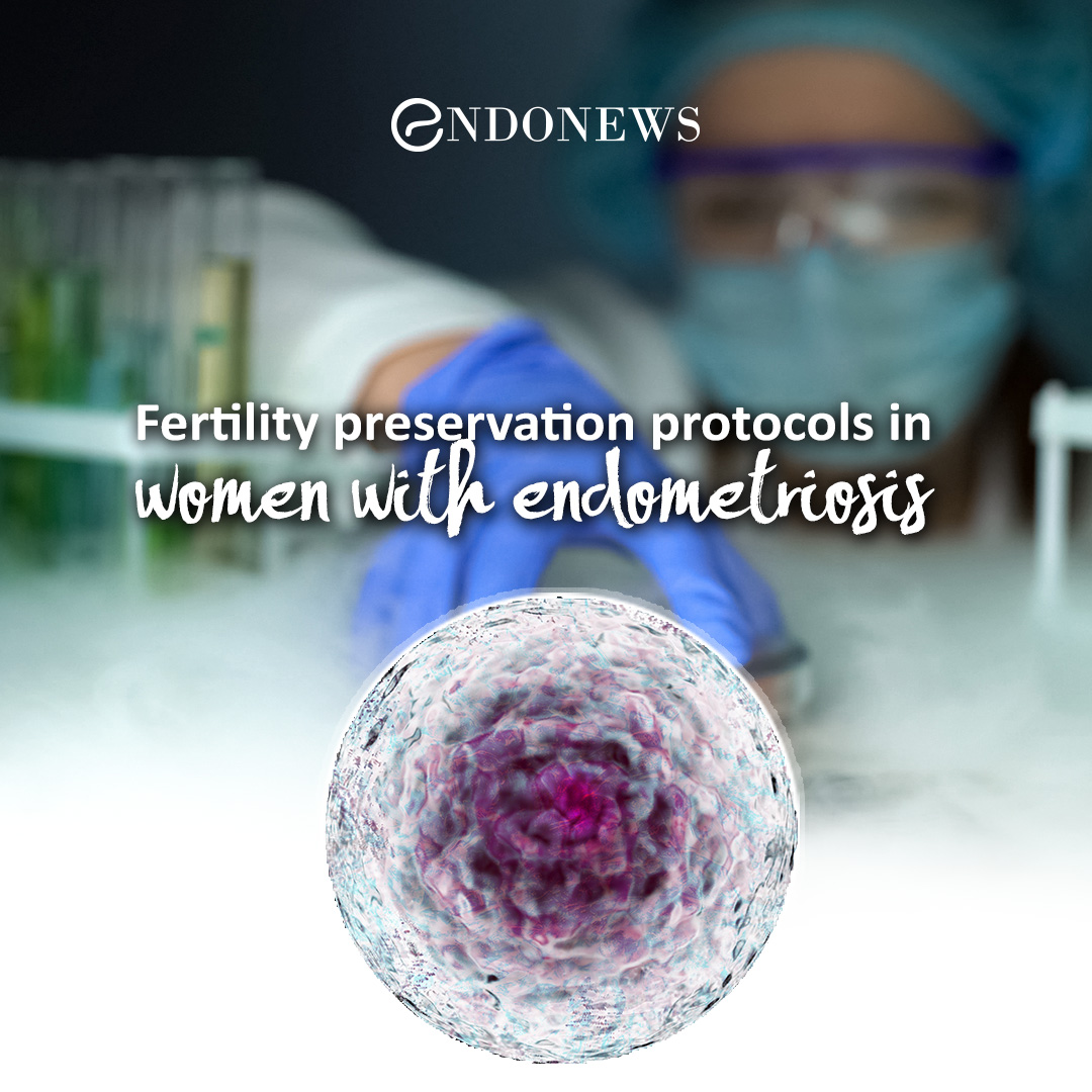 Fertility preservation protocols in women with endometriosis EndoNews
