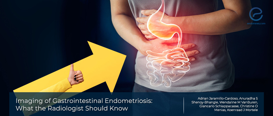 Imaging of gastrointestinal endometriosis
