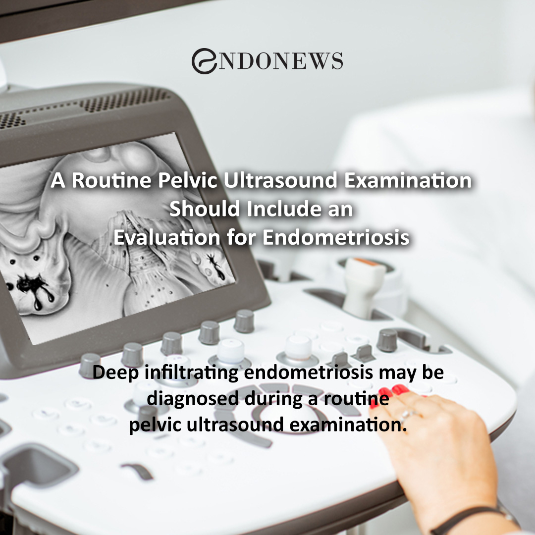 A Routine Pelvic Ultrasound Examination Should Include an Evaluation