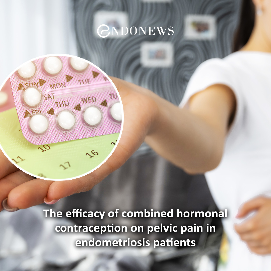 The efficacy of combined hormonal contraception on pelvic pain in endometriosis patients EndoNews