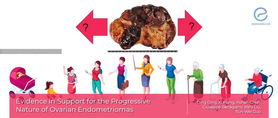 Progressive nature of ovarian endometrioma