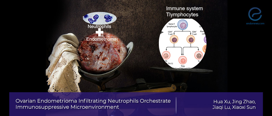 White blood cell neutrophils link to immunosuppressive environment in ovarian endometrioma