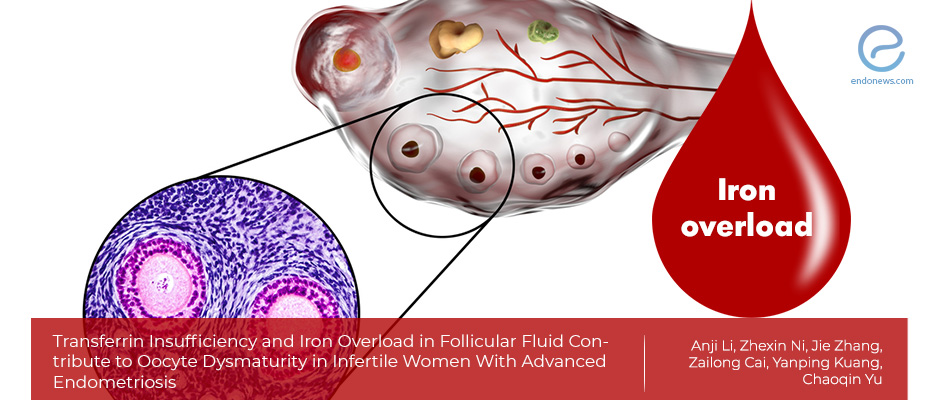 Iron overload in follicular fluid in Endometriosis