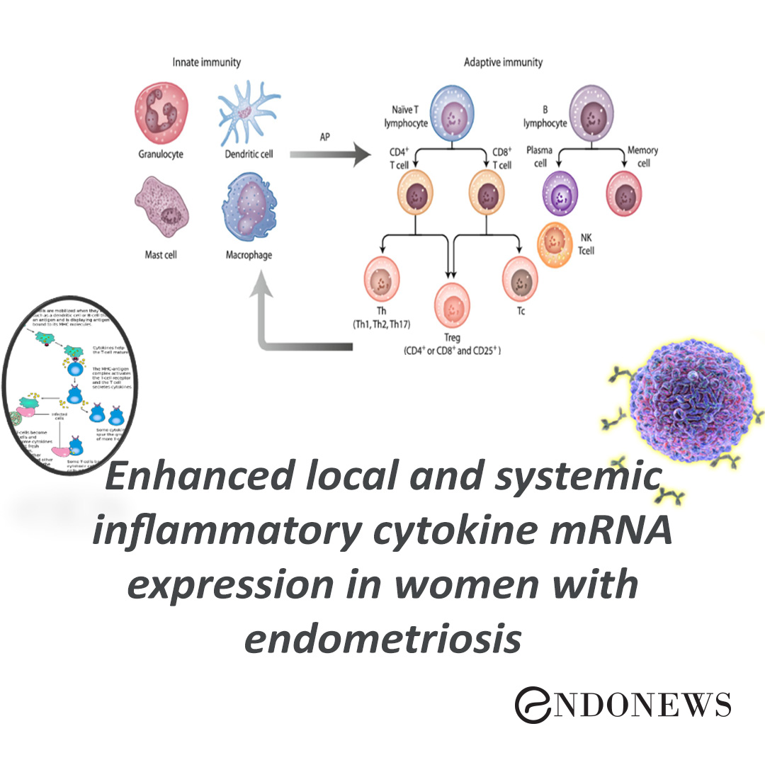 Enhanced local and systemic inflammatory cytokine mRNA expression in women with endometriosis