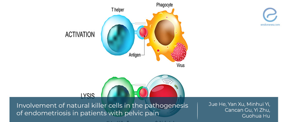 Immune cells and endometriosis pain