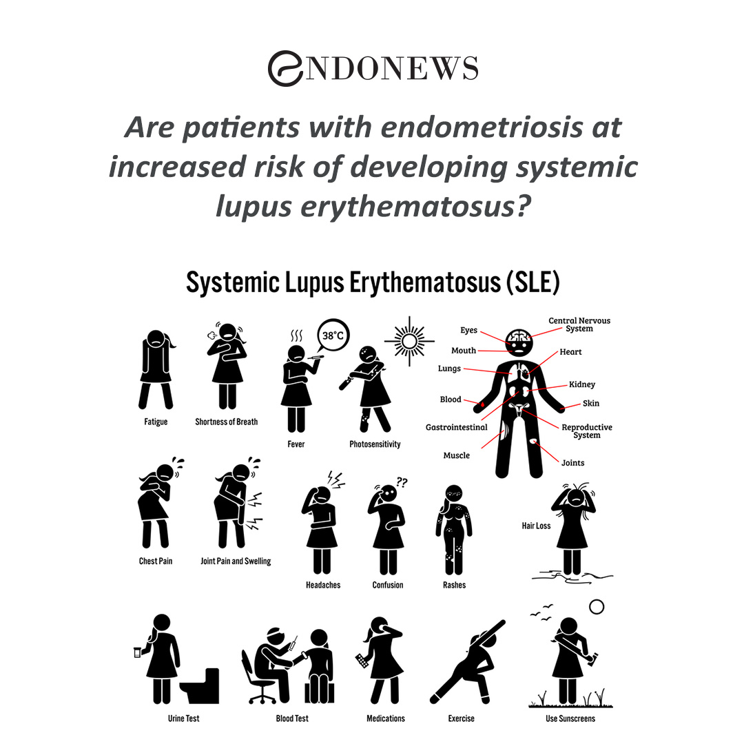 Is there a commonality between endometriosis and systemic lupus? EndoNews