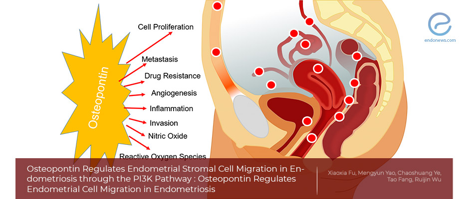 Osteopontin and Endometriosis