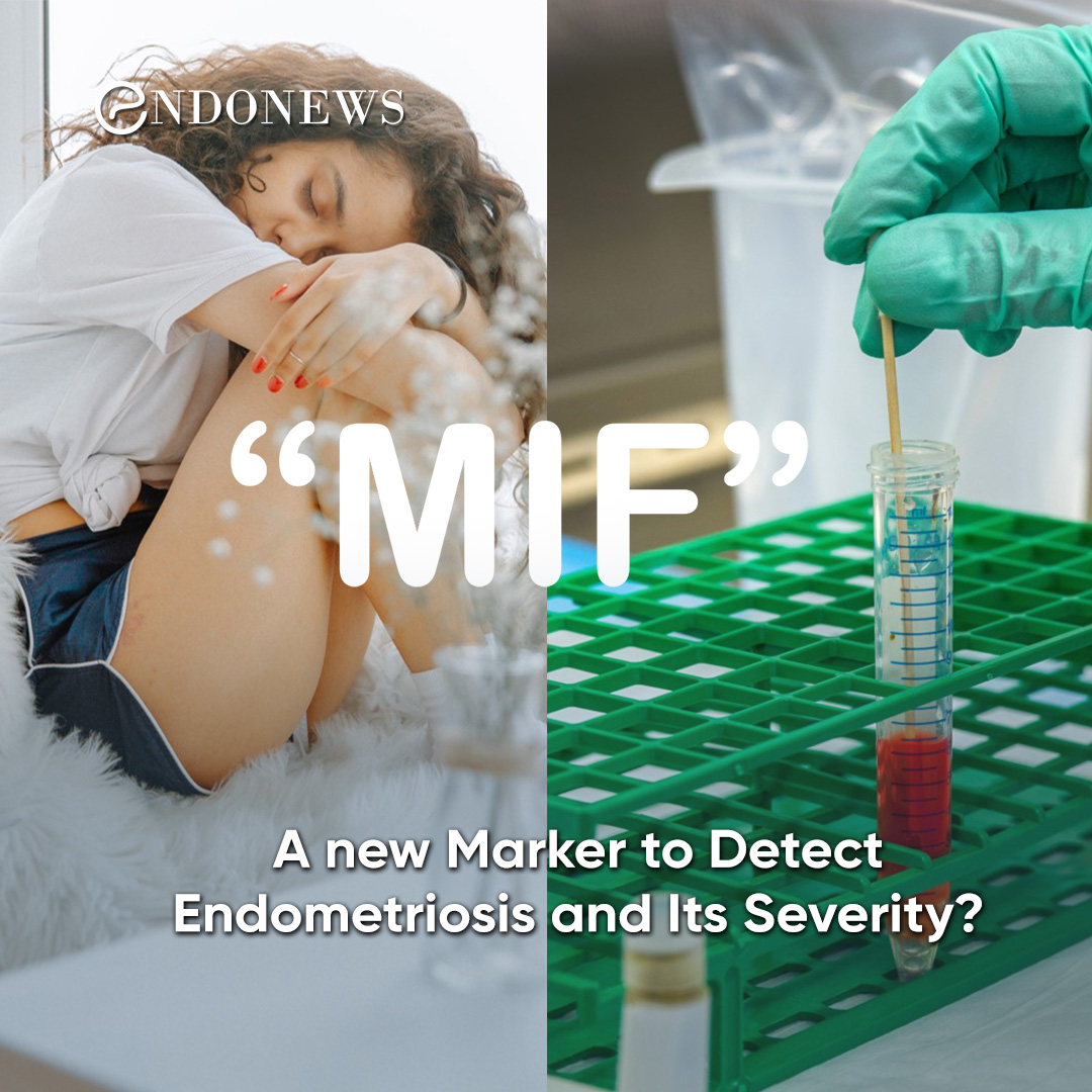 A new Marker to Detect Endometriosis and Its Severity? EndoNews