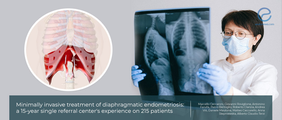 The largest series of diaphragmatic endometriosis 