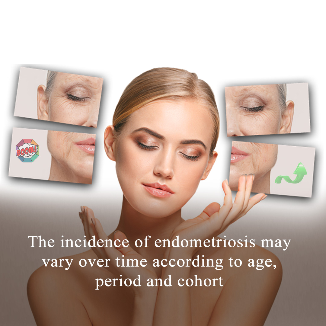 The incidence of endometriosis may vary over time according to age