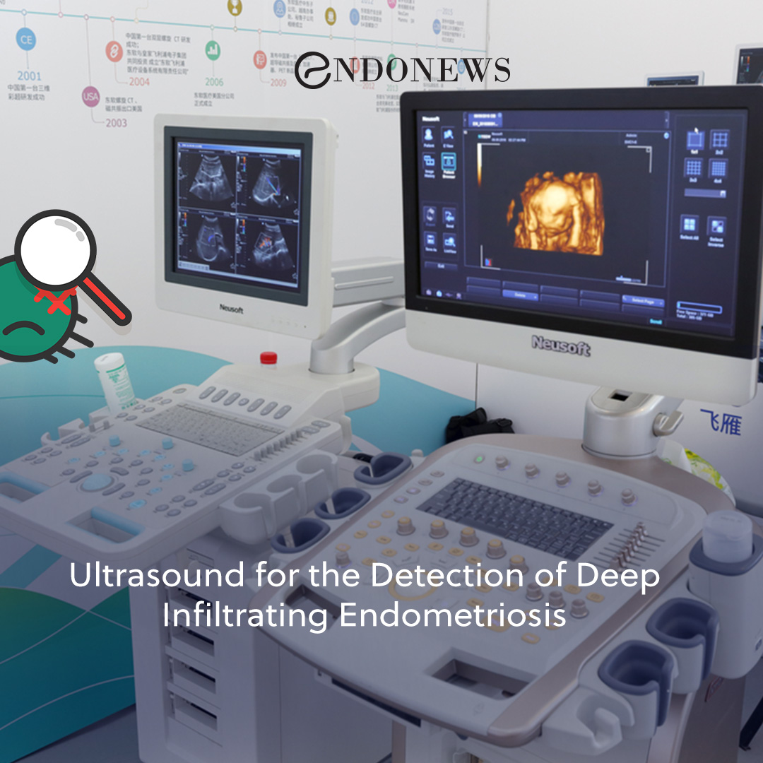 Ultrasound for the detection of deep infiltrating endometriosis endonews