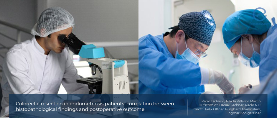 A comparison of symptomatology and histopathologic features in surgically resected colorectal endometriosis