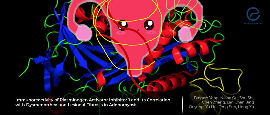 The cause of PAIN in patients with adenomyosis