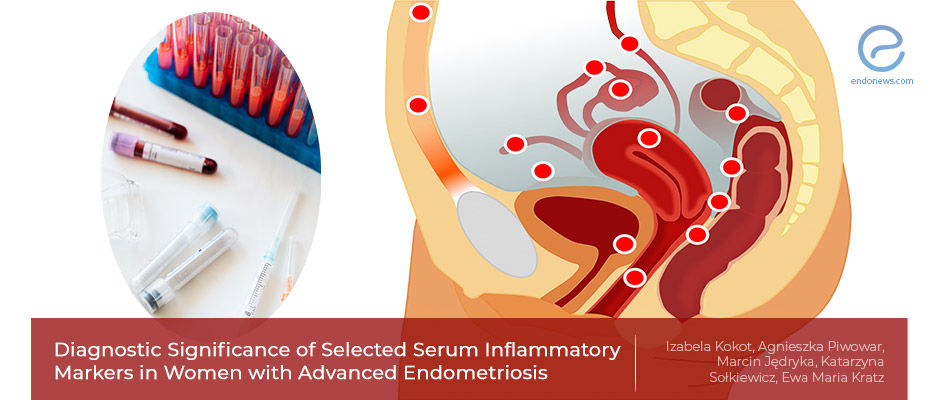 Selected Blood Inflammatory Biomarkers May Help Identify Endometriosis