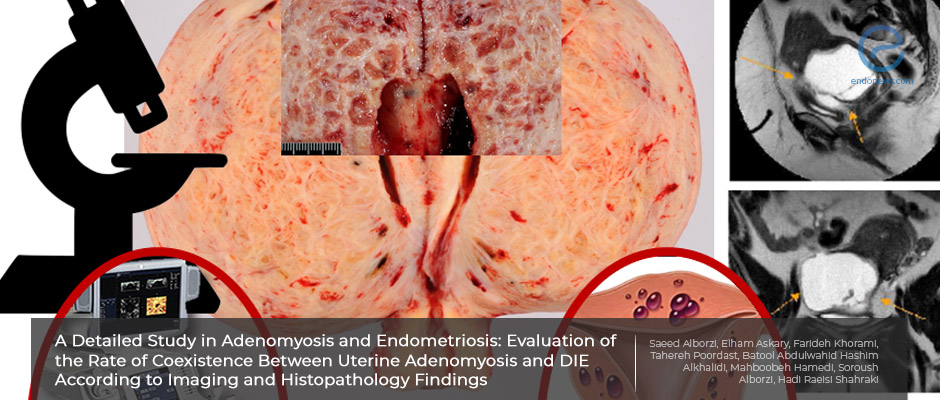 Adenomyosis: accuracy of the diagnostic methods and the synchronism with deep infiltrating endometriosis