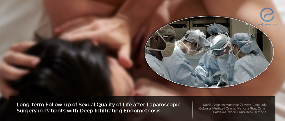 Endometriosis Surgery Improves Sex Life
