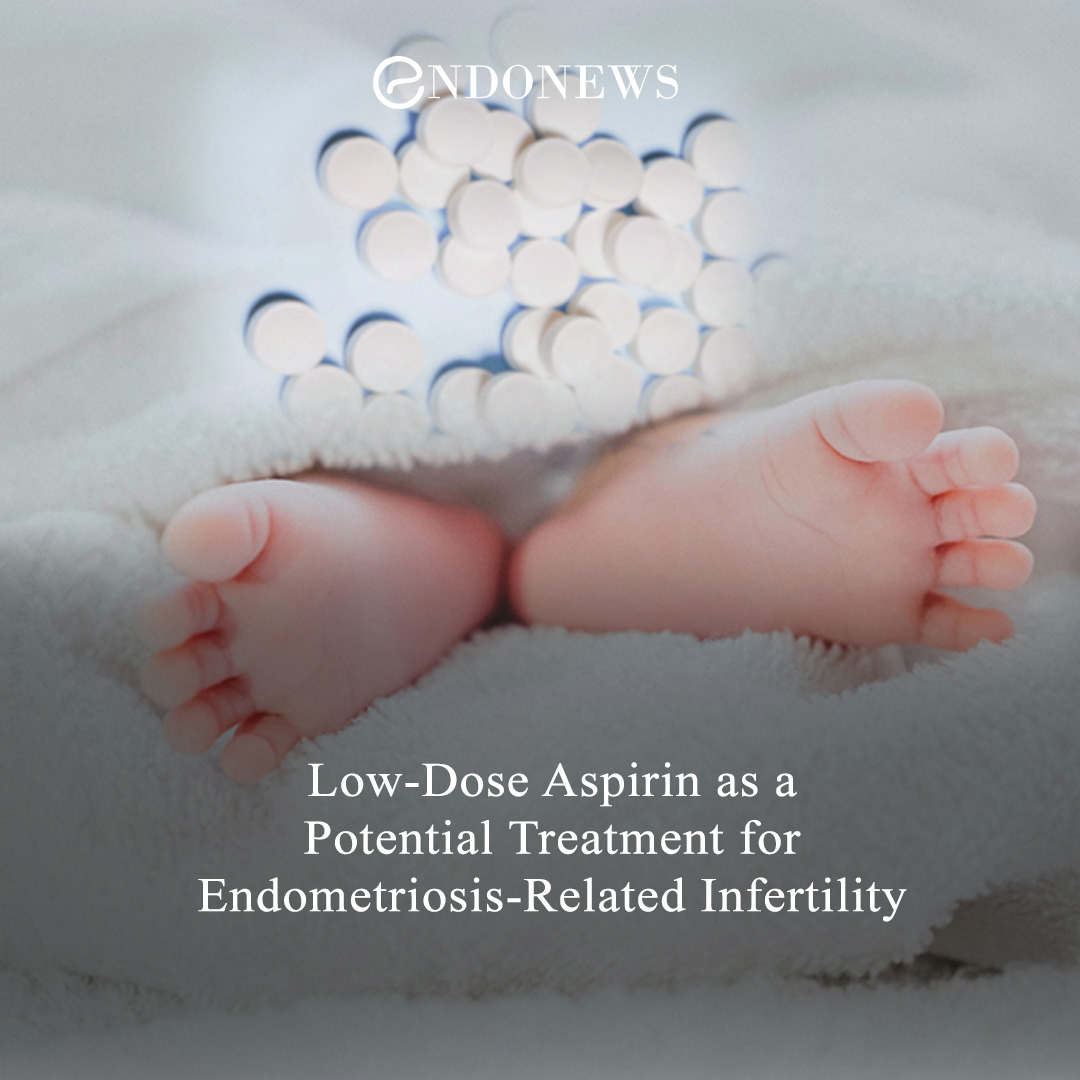 LowDose Aspirin as a Potential Treatment for EndometriosisRelated