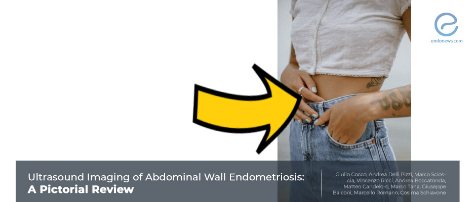A pictorial overview of abdominal wall endometriosis  