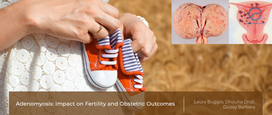 Adenomyosis, fertility, and obstetric outcomes