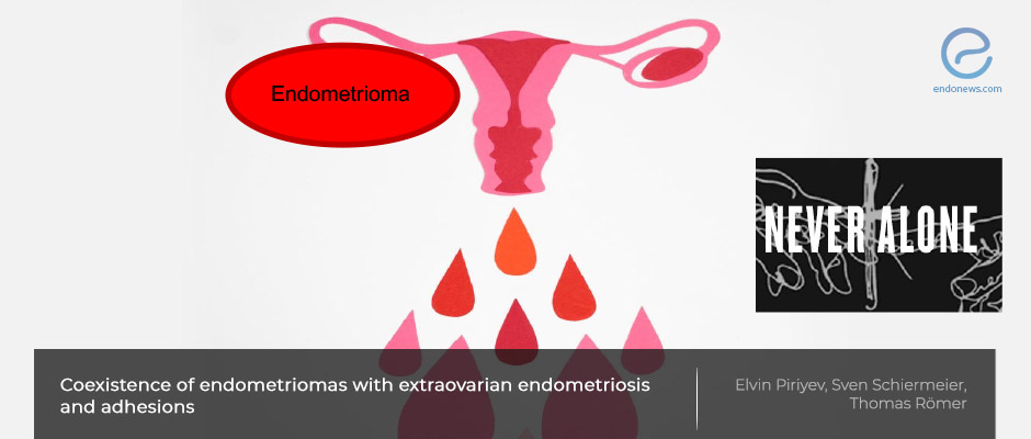 It is not that simple: endometriomas are almost never alone