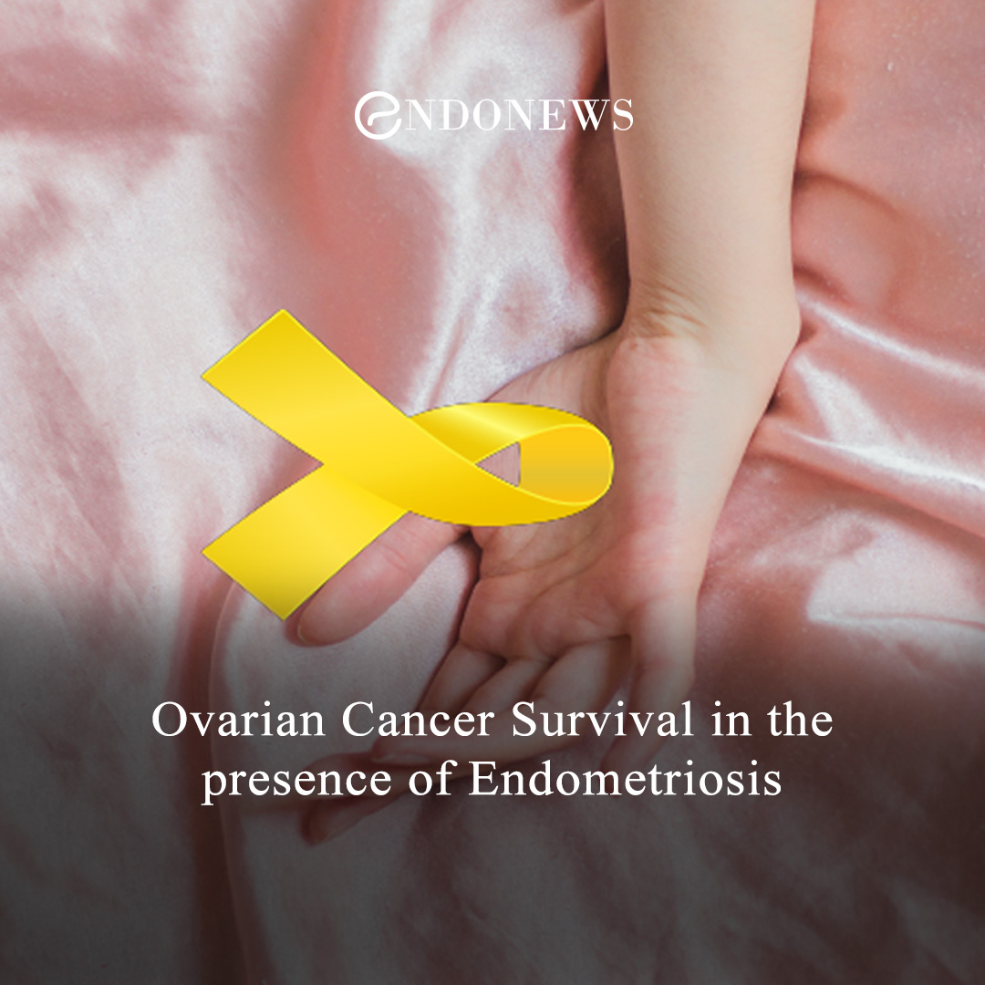 Ovarian Cancer Survival in the presence of Endometriosis EndoNews