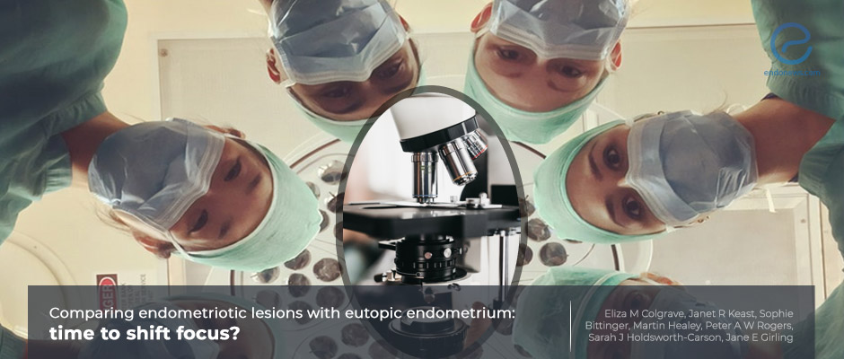 Not all endometriotic lesions behave similar to the eutopic endometrium