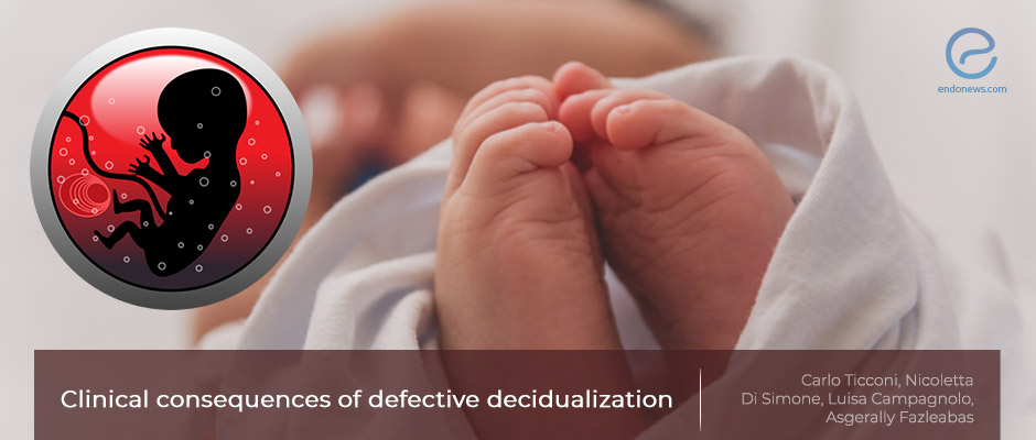 Altered Decidualization and Pregnancy Complications