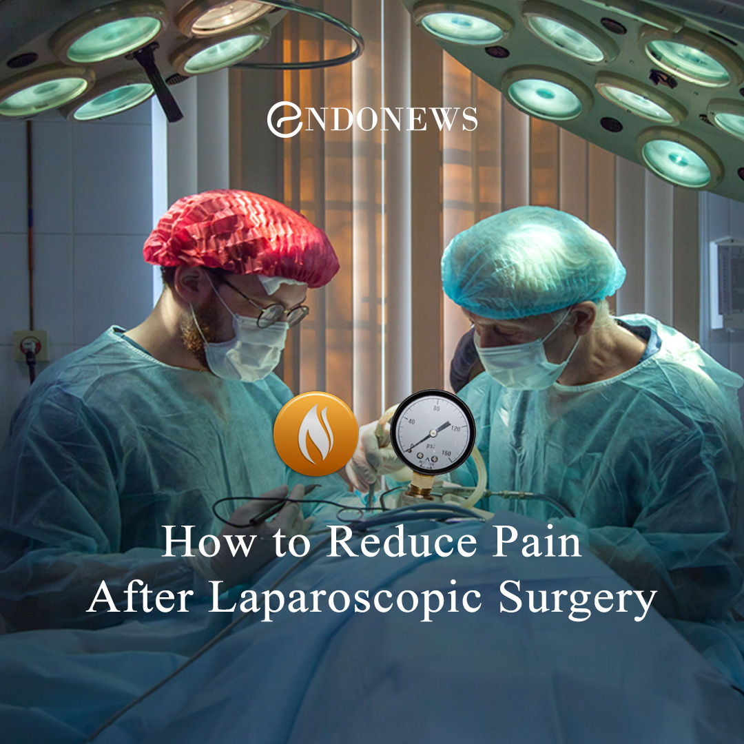 How to Reduce Pain After Laparoscopic Surgery EndoNews