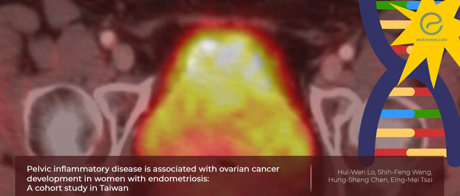 Endometriosis, pelvic inflammatory disease and ovarian cancer