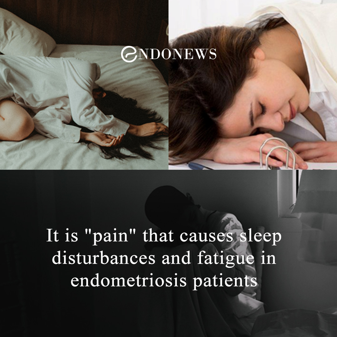 It is "pain" that causes sleep disturbances and fatigue in endometriosis patients EndoNews