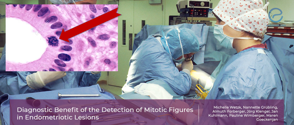 The relevance of mitosis in endometriotic tissue biopsies 