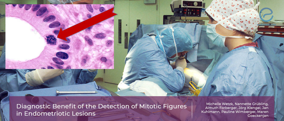 The relevance of mitosis in endometriotic tissue biopsies