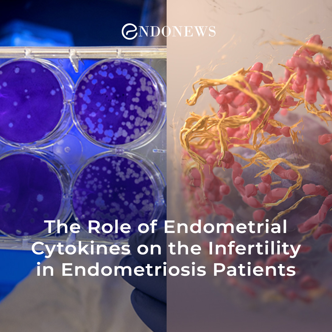 The Role Of Endometrial Cytokines On The Infertility In Endometriosis
