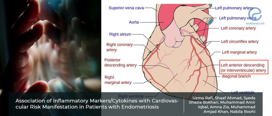 Risk of cardiovascular disease in endometriosis patients