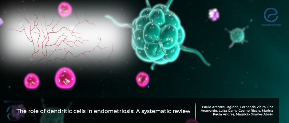 An important enigmatic promoter of endometriosis: immune dendritic cells