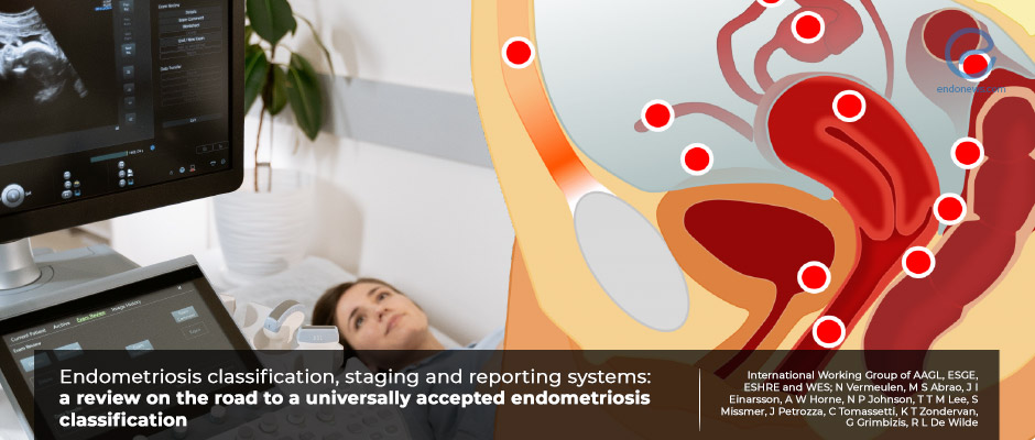 International Working Group's review on endometriosis classification systems