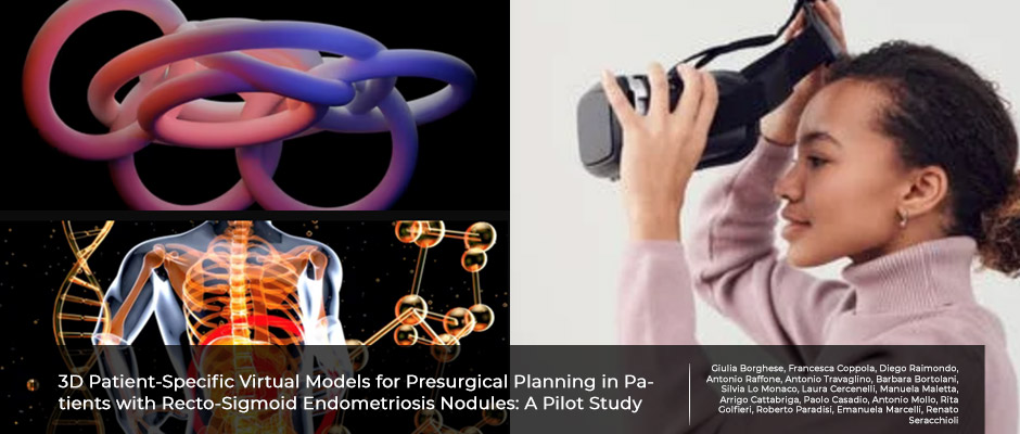 Planning surgery for recto-sigmoid endometriosis with 3D virtual models.