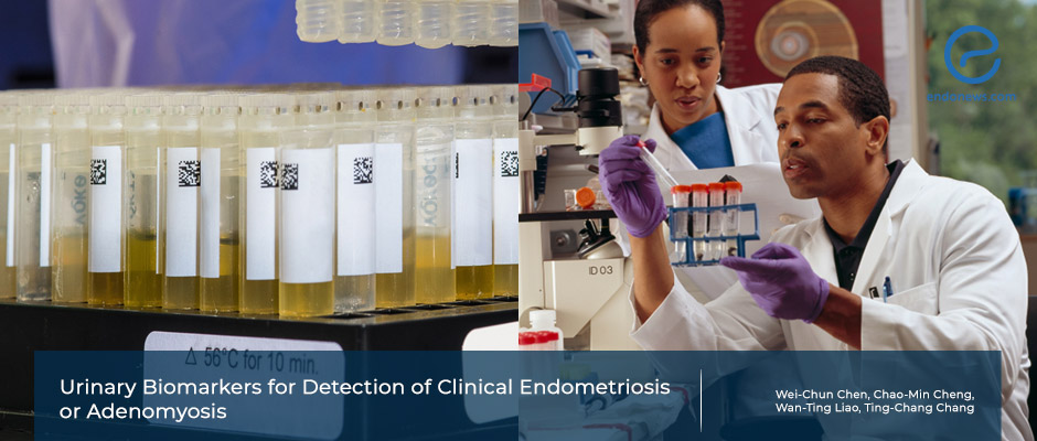 How possible is it to diagnose endometriosis from a urine sample?