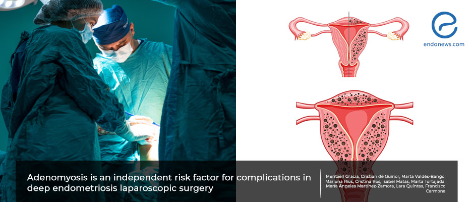 Adenomyosis Increases Risk of Surgical Complications